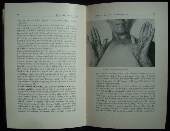 NEMOCI POHLAVNÍ – detail 1