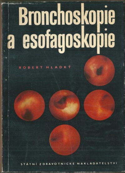 BRONCHOSKOPIE A ESOFAGOSKOPIE
